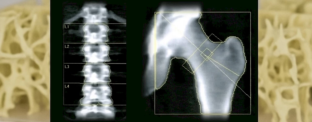 Osteologie, Ausgburg